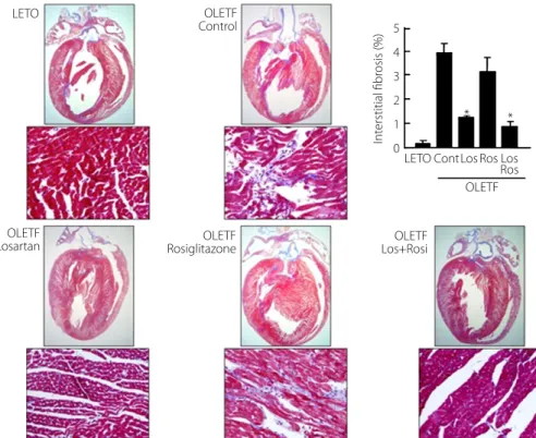 Table 4 shows the functional data from two-dimensional echo- echo-cardiography and strain rate imaging at baseline and after  treat-ment