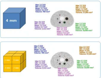 Fig. 3. 4 mm and 2 mm reconstruction image used Workstation  EBW NM (Extended Brilliance Workstation NM, ver.1.0) for NEMA IEC Body phantom.