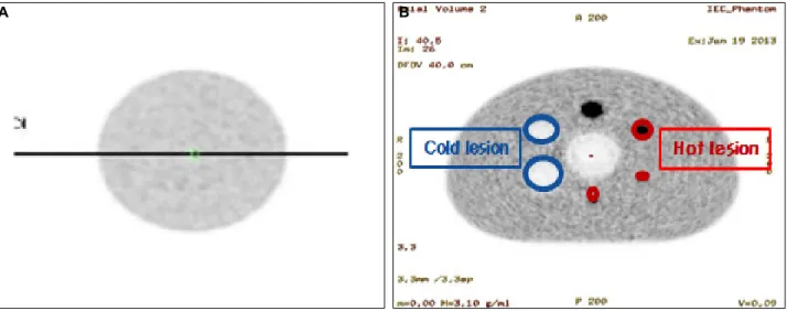 Fig. 1. PET/CT Discovery 710 were used.