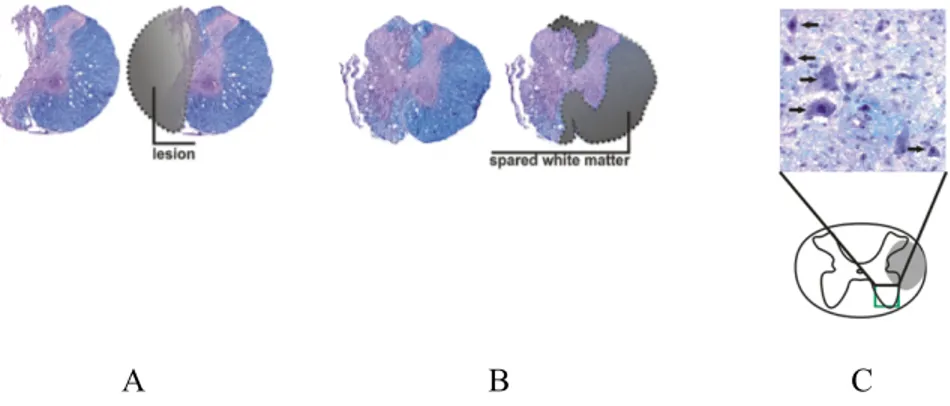 Figure 2. Assessment of lesion volume (A), spared white matter (B), and motor  neurons (C)