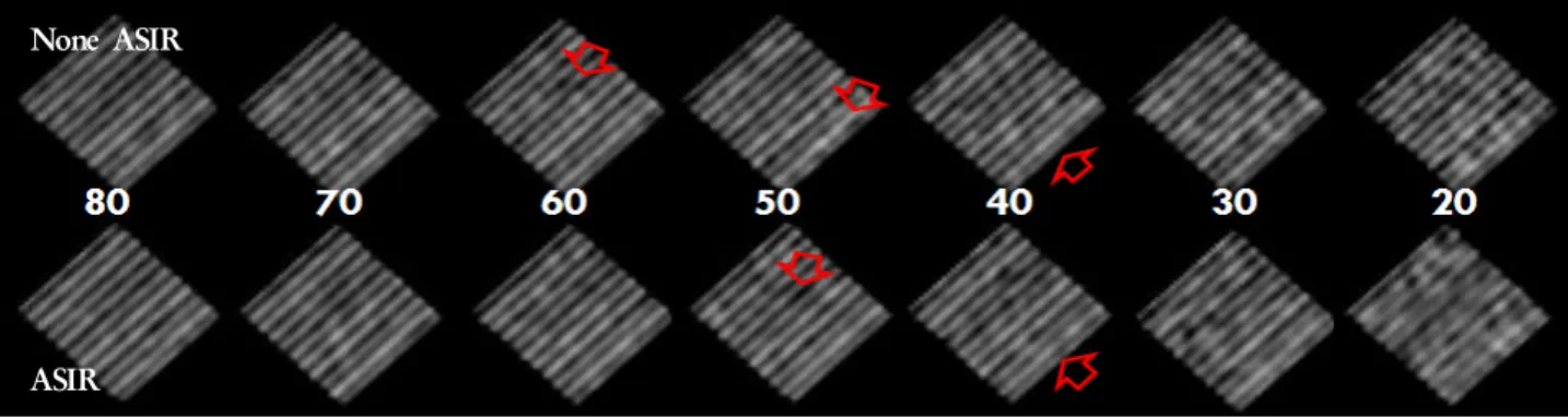 Fig. 9. When ASIR was used high CNRs were found from 80 to  40 mA which are higher than 0.81