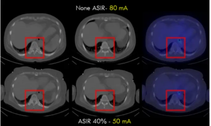 Fig. 12. Even though we reduced 40 mA, the image quality was  not affected by it. 