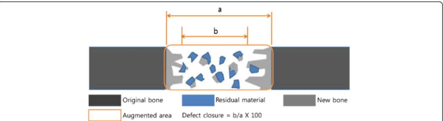 Figure 2 Schematic diagram of histomorphometric analysis.