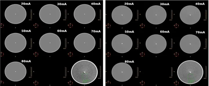 Fig. 10. These pictures are noise test images of helical (left) and flat-panel (right) CT.