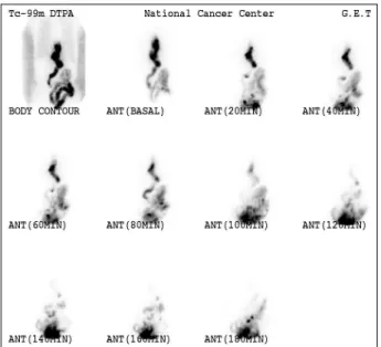 Fig. 7. Based on the half-life was divided into three steps: Over  180 minutes was defined as delayed gastric emptying.