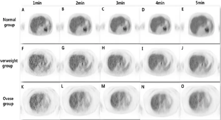 Fig. 3. PET/CT images are each acquisition time of three groups. 1 min acquisition time of each groups (A, F, K)