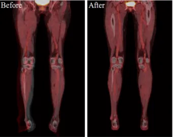 Fig. 8. Images defected due to Lower extremity movements.