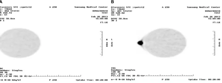 Fig. 2. (A) The image was reconstructed after phantom scan. (B) The image was reconstructed after moving the center of DFOV not to  overlap with hotspot.