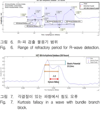 Fig. 6. Range  of  refractory  period  for  R-wave  detection.