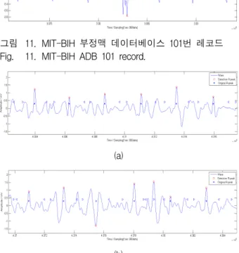 그림 15. MIT-BIH  부정맥  데이터베이스  116번  레코드 Fig. 15. MIT-BIH  ADB  116  record.
