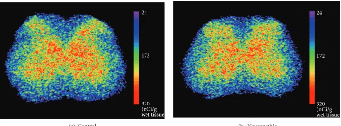 Figure 3: Representative pseudocolor-enhanced images showing metabolic activities in the L3 lumbar spinal cord of control (a) and neuropathic (b) rats after peripheral stimulation