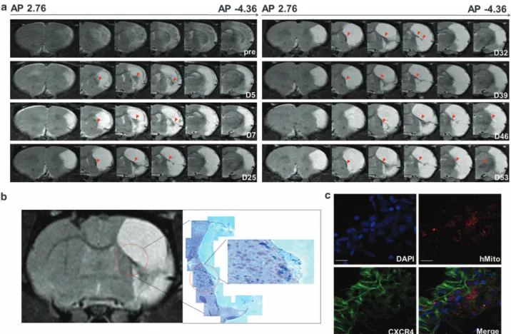 Figure 2 Detection and visualization of Feridex-labeled human embryonic stem cell-derived neural precursor cells (hESC-NPCs, ENStem-A) using 7.0T animal magnetic resonance imaging (MRI) and histological methods