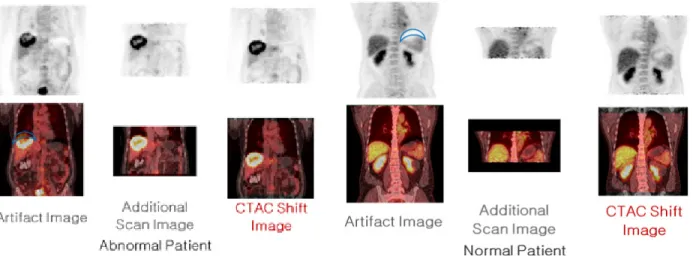 Fig. 4. The image shown three images of normal patient and abnormal patient.