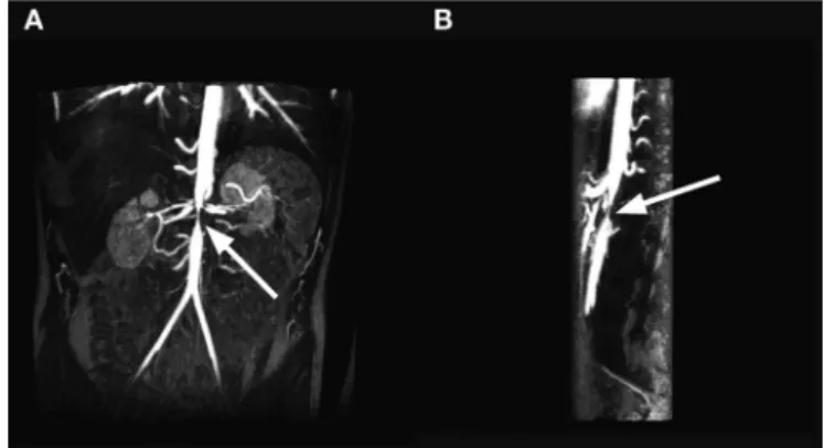 Table 5. Practical suggestions for pediatric MRi: contrast medium 