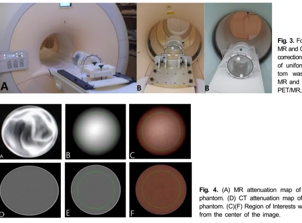 Fig. 3. For the comparison of  MR and CT-based attenuation  corrections, transmission scans of uniformity cylinder  phan-tom was performed using  MR and  two type of CT (A: 