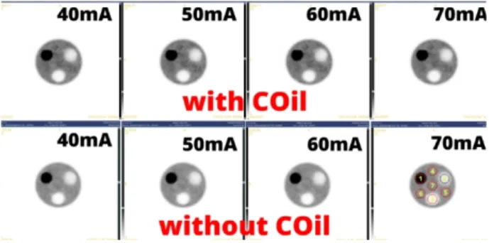 Fig. 4. (upper row) Using MR Torso Coil, uniformity was  compared. (lower row) MR Torso Coil was moved, the same  protocol was applied.
