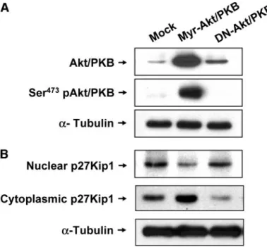 Fig. 5. Kaplan-Meier survival curves for the disease-free survival and overall survival rates of patients with acute myelogenous leukemia, according to the cytoplasmic to nuclear ratio (C:N) ratio of the p27Kip1 localization