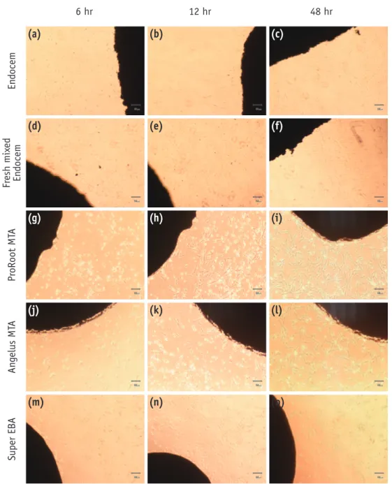 Figure 1.  Morphological changes of periodontal ligament cells in contact with each experimental material