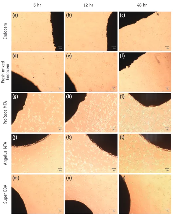 Figure 1.  Morphological changes of periodontal ligament cells in contact with each experimental material