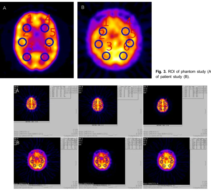 Fig. 3. ROI of phantom study (A), ROI  of patient study (B).