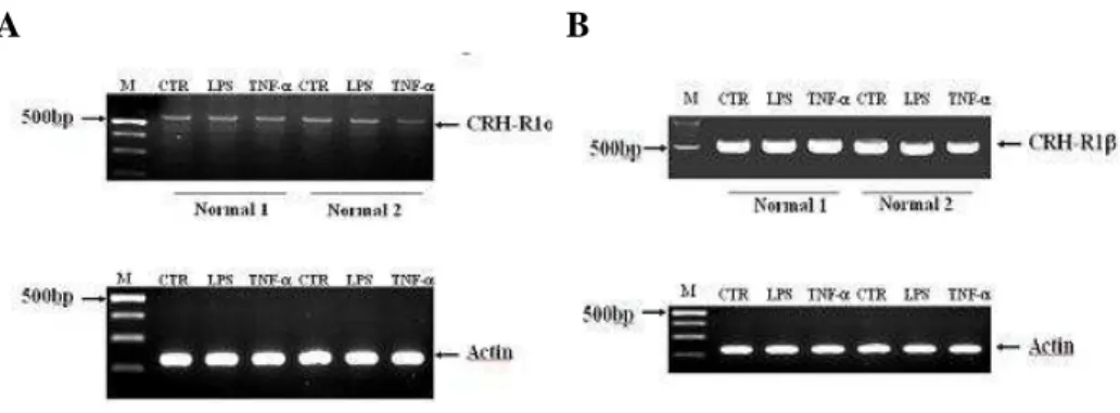 Figure  1.  RT-PCR  analysis  of  CRH-R1  isoforms  mRNA  in  DCs  of  two  healthy  controls