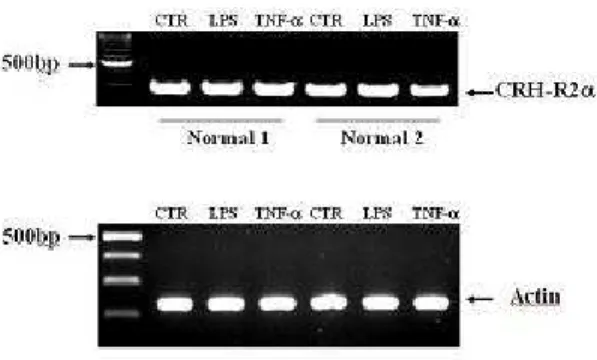 Figure  2.  RT-PCR  analysis  of  CRH-R2  isoforms  ( α,  β,  γ)  mRNA  in  DCs  of  two  healthy  controls
