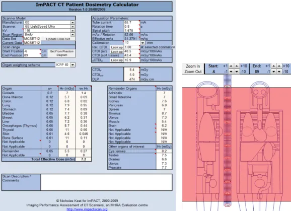 Fig. 1. Enter the parameters which are vendor, scanner type, kV, mA, rotation cycle, pitch, collimation and scan range you can get  the effective dose(ImPACT v1.0).