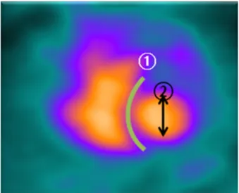 Fig. 5. EF processing by both ROI modes.