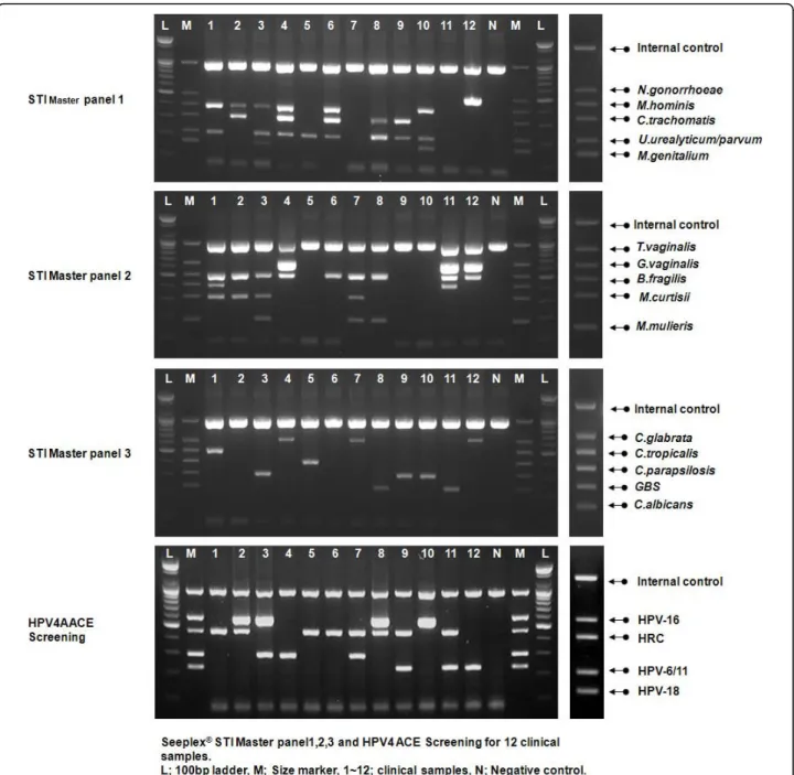 Figure 1 Sexually transmitted infection and human papillomavirus (HPV) multiplex PCR. Representative data of multiplex PCR with four multiplex primer mixes: Seeplex® STI Master Panel 1 (MP1), 2 (MP2), 3 (MP3) and HPV4A ACE Screening