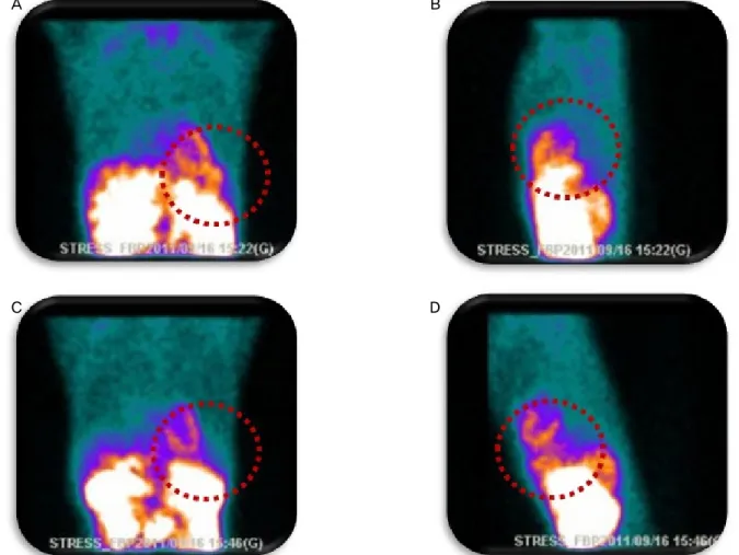 Fig. 3. The overlapping of the internal organs with the part of a heart is observed from front and side view to the image taking the  case of basic posture of supine (Red circle in a and b)