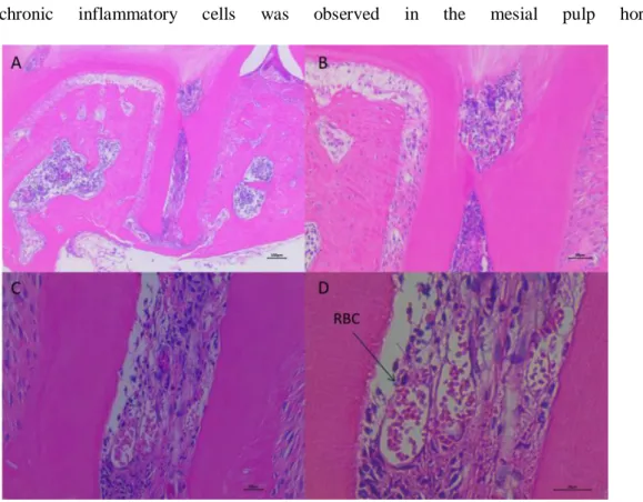 Fig. 4. One day after pulp exposure. (A, B) Dilation of the pulp blood vessels was observed (x 40,  x 100)