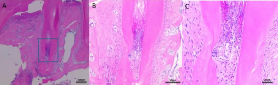 Fig. 9. Twelve days after pulp exposure. (A) Necrosis up to one-third of the way to the apex    (x  40)