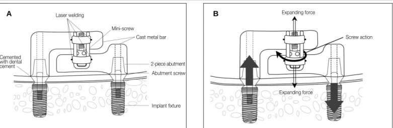 Table 2 shows the results of  each implant,  grouping, initial stability and the remarkable events during the experiment