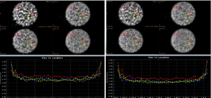 Fig. 7. ROI was set up on the each reconstructed image, performed the comparative analysis SUV