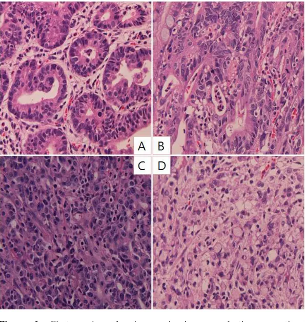 Figure 1. Photographs of microscopic images of tissue sections according to histologic differentiation status