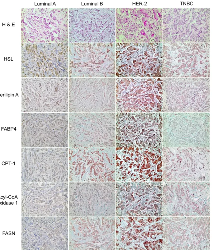 Fig 2. Expression of lipid metabolism related proteins according to the molecular subtypes of breast cancer