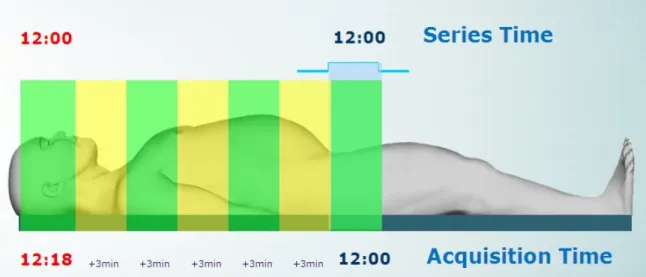 Fig. 5. Series Time and Acquisition Time