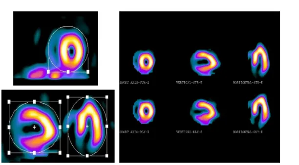 Fig. 1. Myocardial extract display