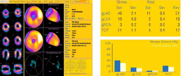 Fig. 2. The quantification of myocardial perfusion using automatic quantification software