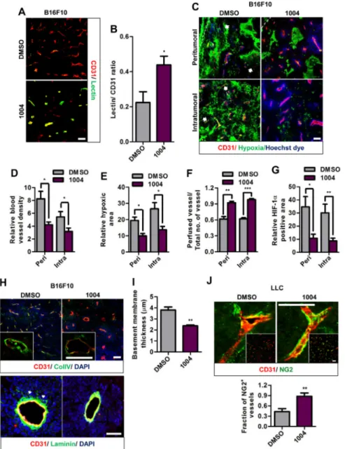 Figure 2: Sac-1004 improves vascular perfusion, alleviates hypoxia and normalizes tumor blood vessels in tumors