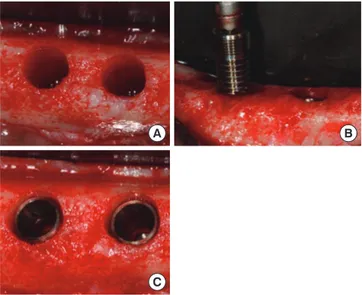 Figure 1.  Clinical photographs of the experiment. (A) Implant sites 