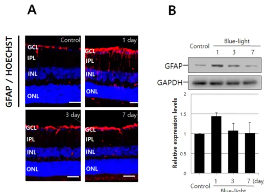 Fig. 1. Blue-light promotes retinal gliosis. (A) GFAP expression in mouse retina is shown