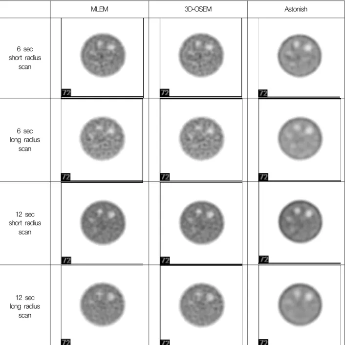 Fig. 9. Flanged Jaszczak ECT phantom images were reconstructed with optimal iteration numbers of each method which were  chosen with NEMA IEC PET body phantom test.