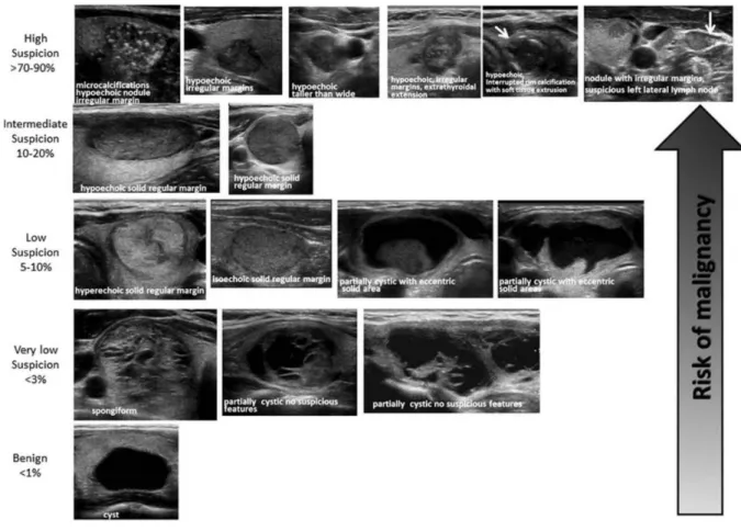 Figure 1. ATA nodule sonographic patterns and risk of malignancy (Thyroid. 2016 Jan 1; 26(1): 1– 133)