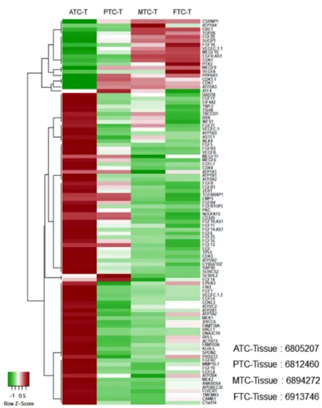 Figure  9.  Gene  expression  profiles  measured  by  microarrays.  Hierarchical  clustering  analysis  in  between differentiated-, poorly differentiated-and dedifferentiated thyroid cancer of patient tissue