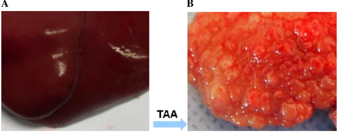 Figure  2.  Liver  section  presenting  normal  liver  (A)  and  cirrhotic  liver  (B)  induced  by  intraperitoneal  injections  of  thioacetamide  for  12 weeks