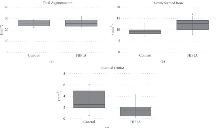 Figure 6: Parameters measured in the histomorphometric analysis: (a) total augmented area (TA), (b) area of newly formed bone (NB), and (c) area of residual bone substitute material (RM)