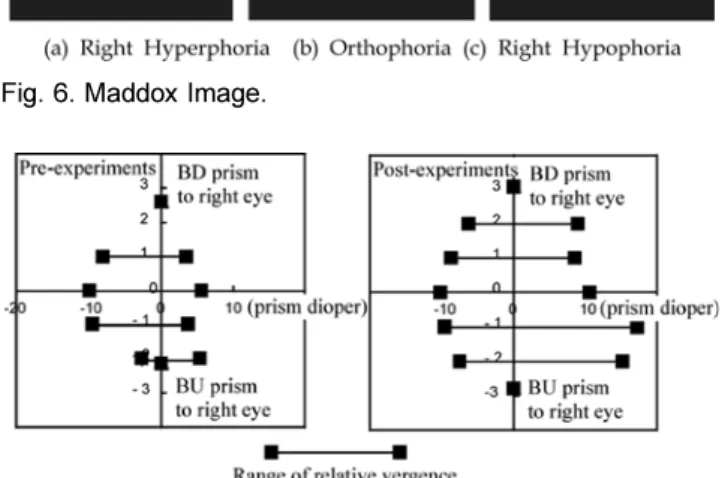 Fig. 7. Training effect of the relative vergence when prism was burdened to viewer's right eye