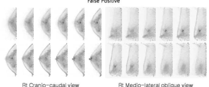 Fig. 5. This picture shows the false positive result.