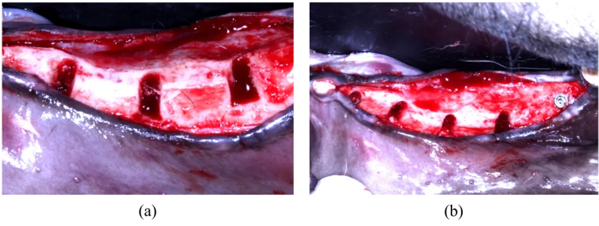 Fig. 3. Formation of bone defects 